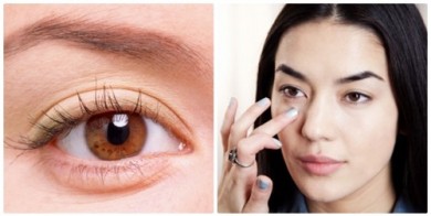 Bệnh thâm quầng mắt theo lý giải của chuyên gia y khoa & cách khắc phục